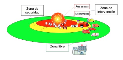 Zonas de intervención